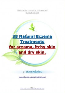 35 All Natural eczema treatments